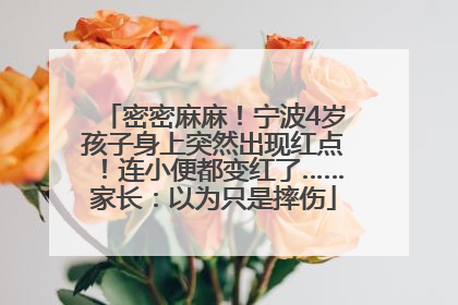 密密麻麻！宁波4岁孩子身上突然出现红点！连小便都变红了……家长：以为只是摔伤