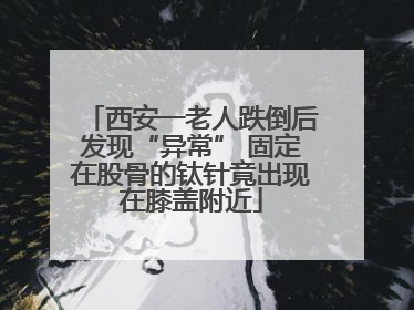 西安一老人跌倒后发现“异常” 固定在股骨的钛针竟出现在膝盖附近